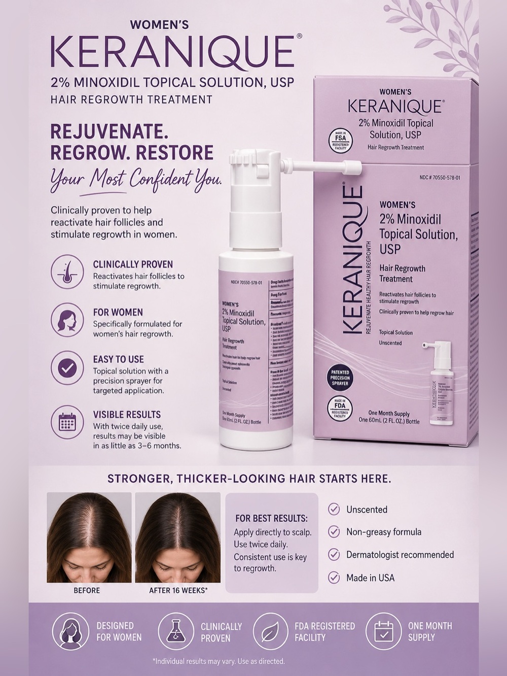 Keranique Women's 2% Minoxidil Topical Solution - Pink